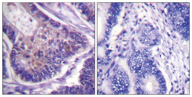 Anti-EIF4B antibody produced in rabbit