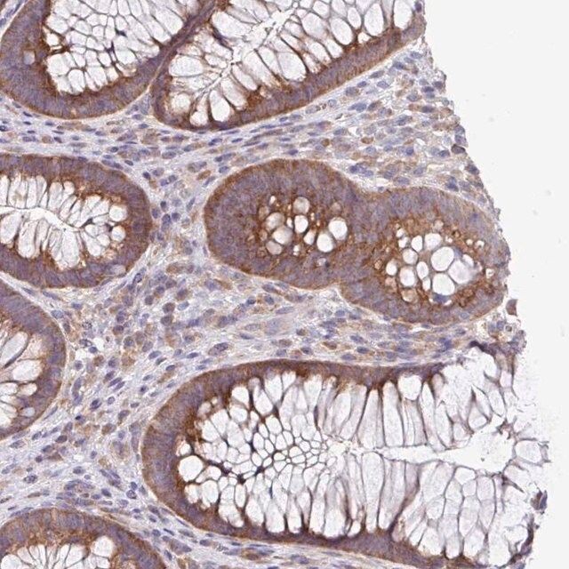 Anti-EIF4B antibody produced in rabbit