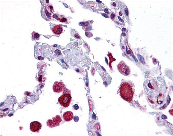 Anti-EIF2AK1 antibody produced in rabbit