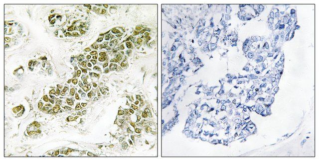 Anti-EIF2  antibody produced in rabbit