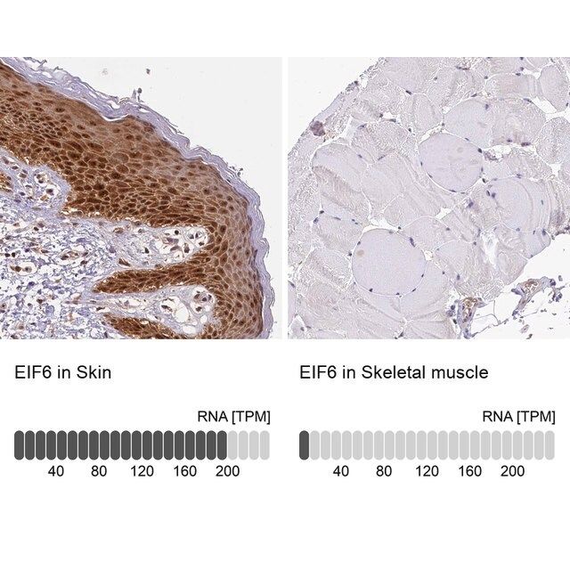 Anti-EIF6 antibody produced in rabbit