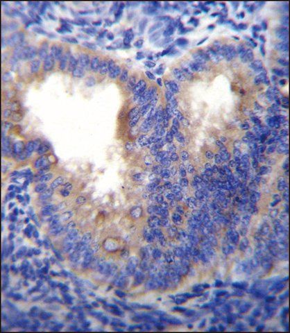 ANTI-EIF5AL1 (C-TERM) antibody produced in rabbit