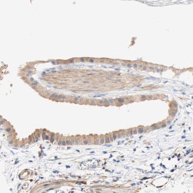 Anti-EIF2AK4 antibody produced in rabbit