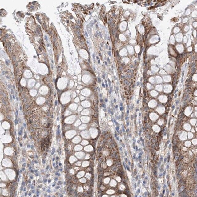 Anti-EIF2A antibody produced in rabbit