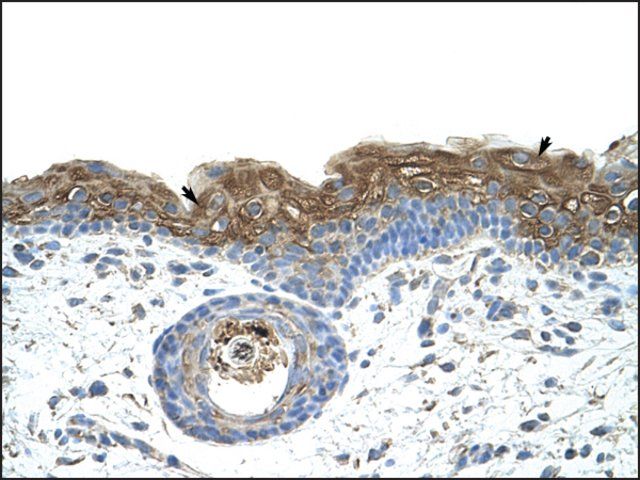 Anti-EIF2A antibody produced in rabbit