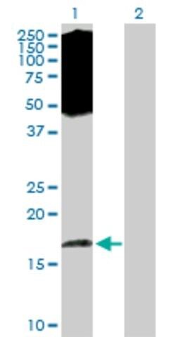 Anti-EIF5A2 antibody produced in rabbit