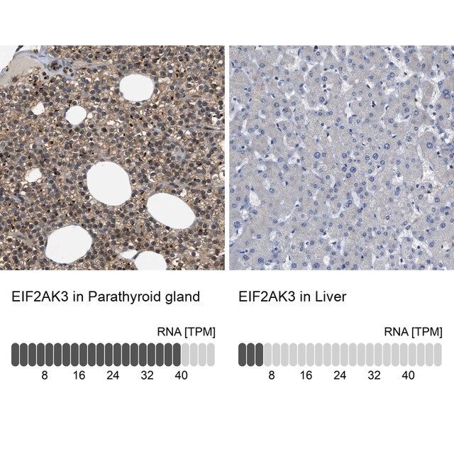 Anti-EIF2AK3 antibody produced in rabbit