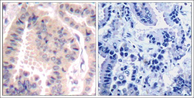 Anti-EIF4B (Ab-422) antibody produced in rabbit