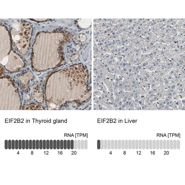 Anti-EIF2B2 antibody produced in rabbit