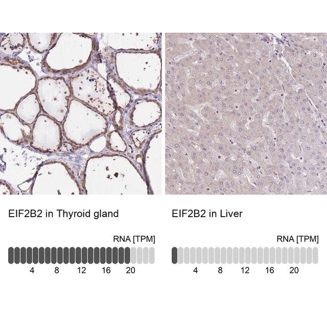 Anti-EIF2B2 antibody produced in rabbit