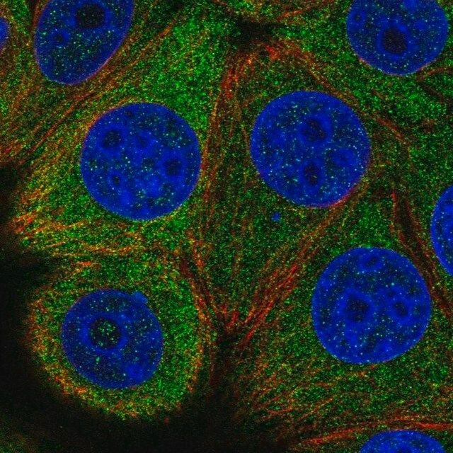 Anti-EIF2B5 antibody produced in rabbit