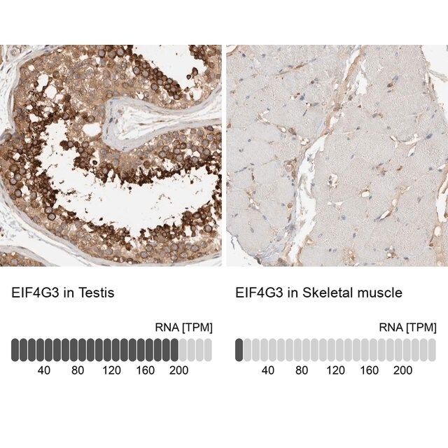 Anti-EIF4G3 antibody produced in rabbit