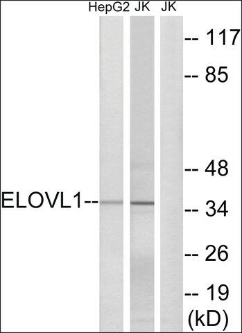 Anti-ELOVL1 antibody produced in rabbit