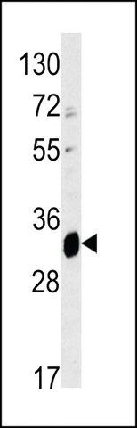 ANTI-ELOVL6(N-TERMINAL) antibody produced in rabbit