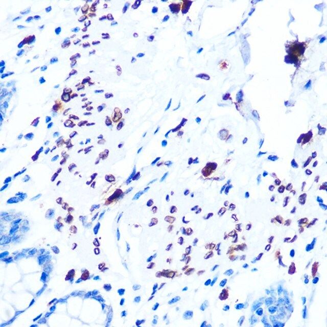 Anti-Emerin/EMD antibody produced in rabbit