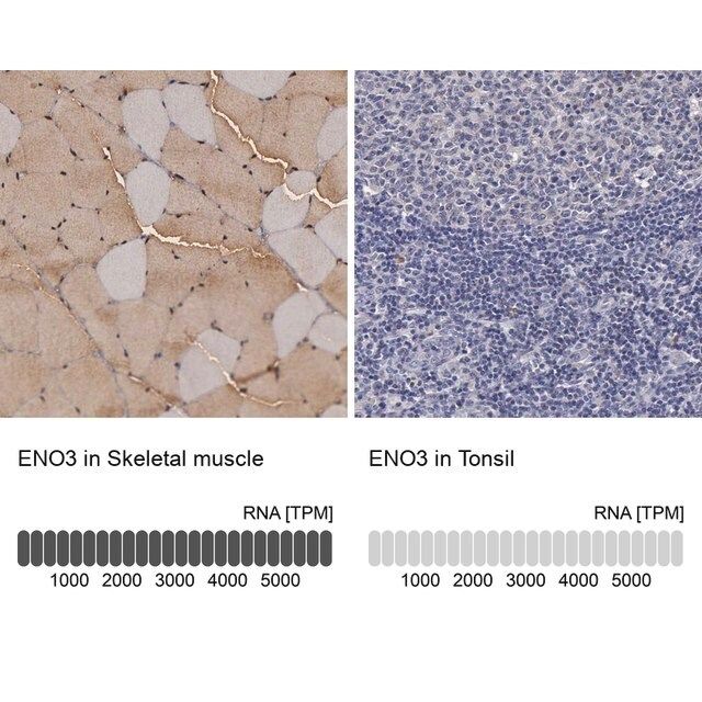 Anti-ENO3 antibody produced in rabbit