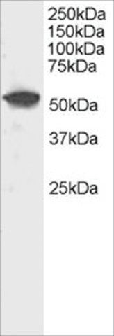 Anti-DUSP10/MKP5 antibody produced in goat