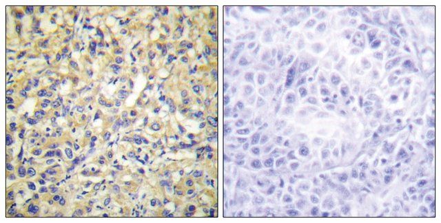 Anti-DUSP9 antibody produced in rabbit