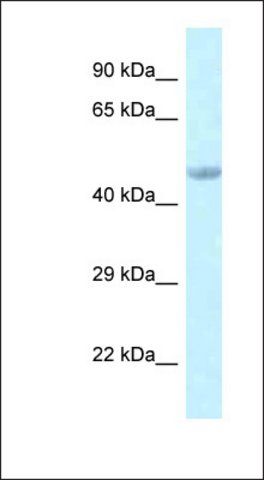 Anti-EED antibody produced in rabbit