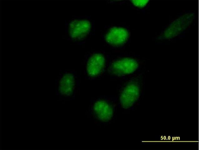 Anti-EED antibody produced in mouse