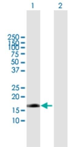 Anti-EDN2 antibody produced in mouse