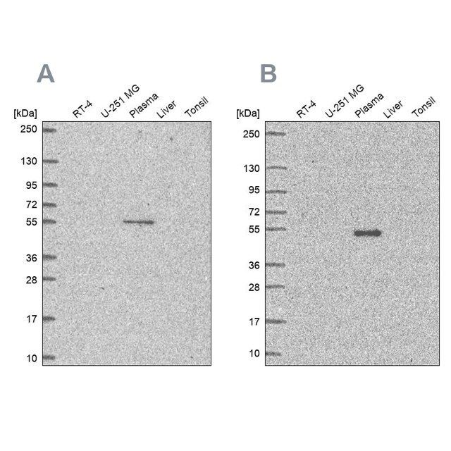 Anti-EED antibody produced in rabbit