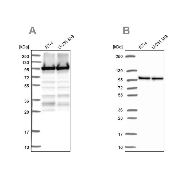 Anti-EEF2 antibody produced in rabbit