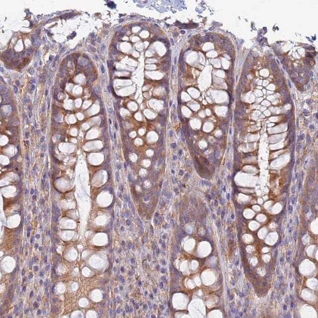 Anti-EEA1 antibody produced in rabbit