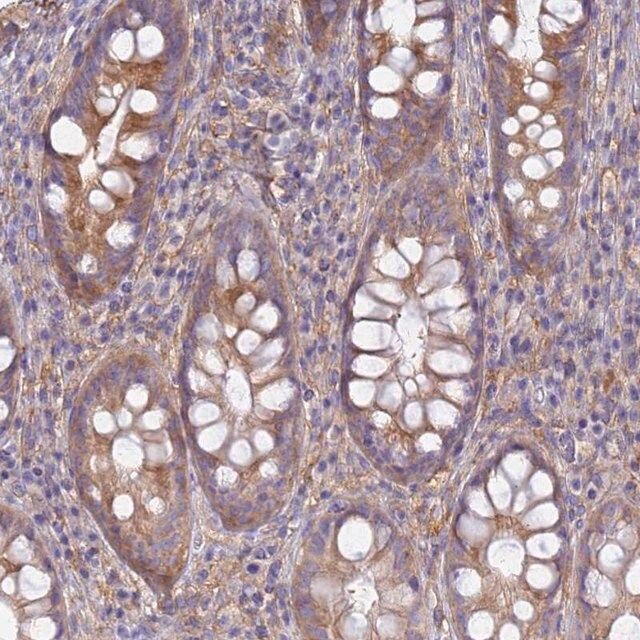 Anti-EEA1 antibody produced in rabbit