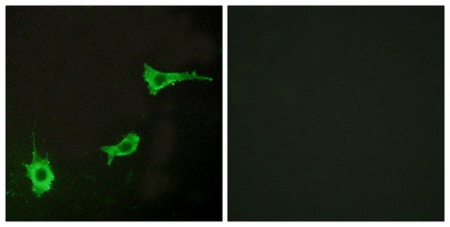 Anti-EDNRA antibody produced in rabbit