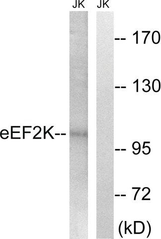 Anti-EEF2K antibody produced in rabbit