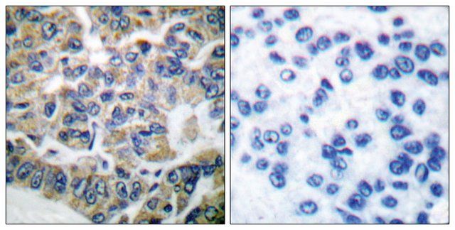 Anti-EEF2K antibody produced in rabbit