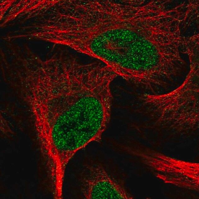 Anti-E2F6 antibody produced in rabbit