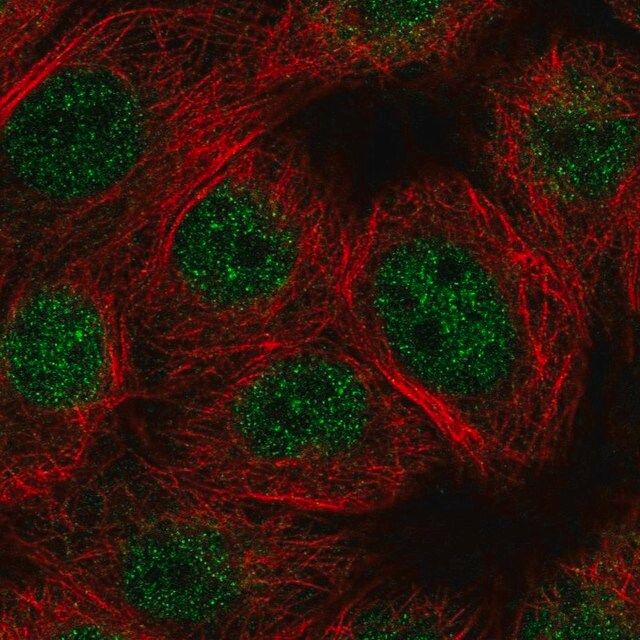 Anti-E4F1 antibody produced in rabbit