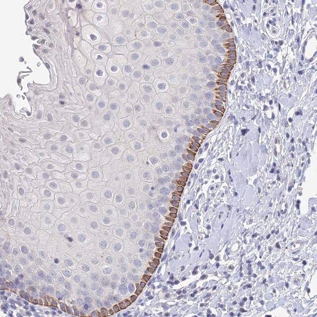 Anti-EEF2KMT antibody produced in rabbit