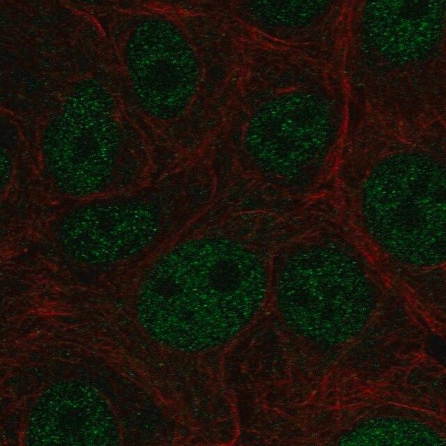 Anti-E4F1 antibody produced in rabbit