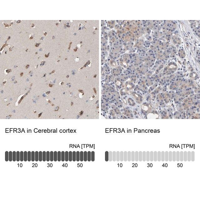 Anti-EFR3A antibody produced in rabbit