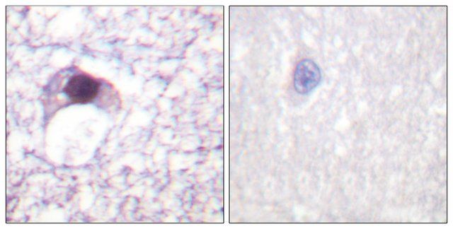 Anti-E2F6 antibody produced in rabbit