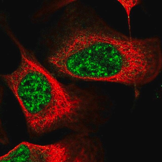 Anti-EEPD1 antibody produced in rabbit