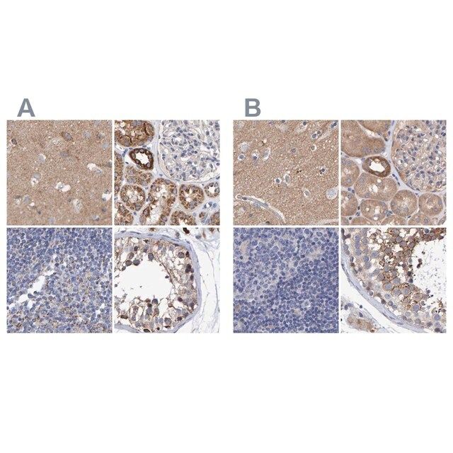 Anti-EFR3A antibody produced in rabbit