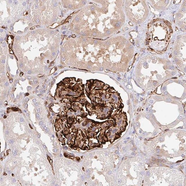 Anti-DOCK1 antibody produced in rabbit