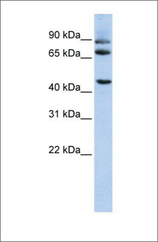 Anti-DPP10 antibody produced in rabbit