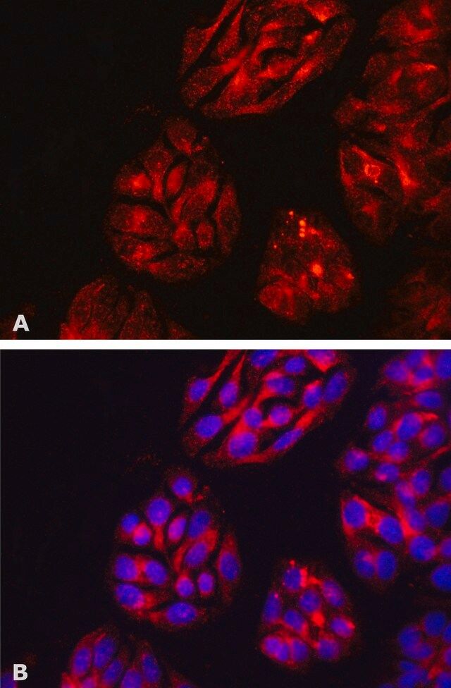 Anti-DPP4/CD26 antibody, Mouse monoclonal