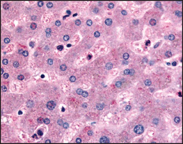 Anti-DPP9 (Internal) antibody produced in rabbit