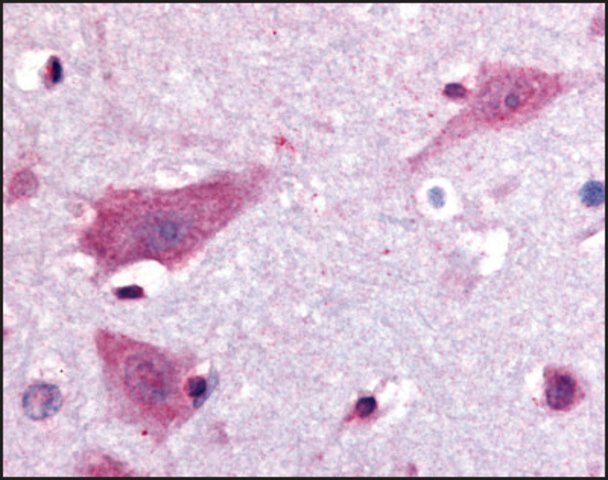 Anti-DPP10 antibody produced in rabbit