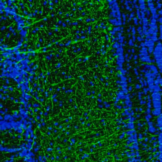 Anti-DPP6 antibody produced in rabbit