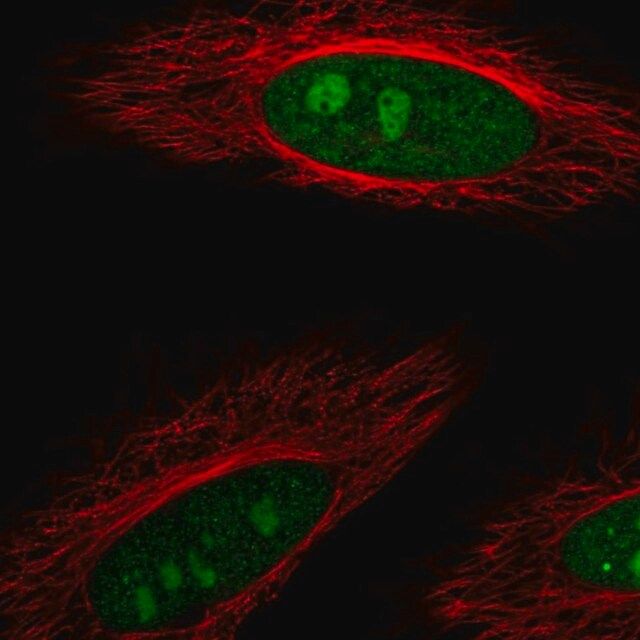 Anti-DDX23 antibody produced in rabbit