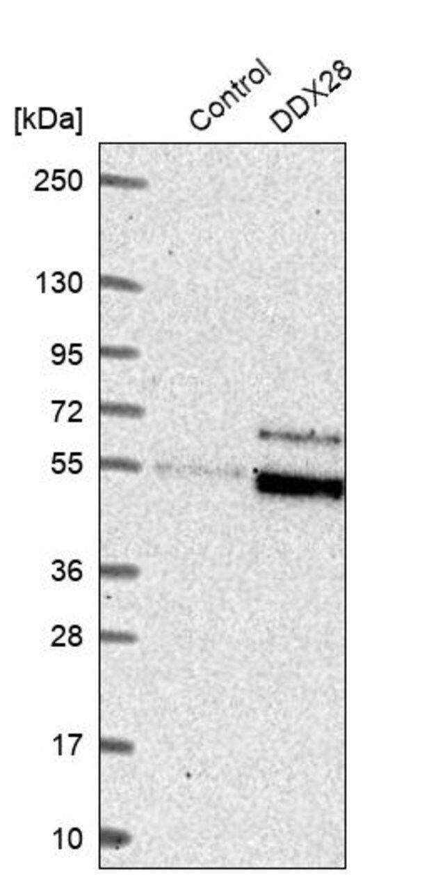 Anti-DDX28 antibody produced in rabbit