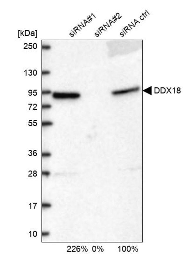 Anti-DDX18 antibody produced in rabbit