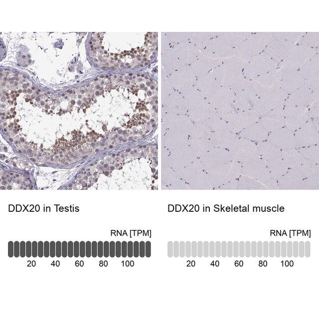 Anti-DDX20 antibody produced in rabbit